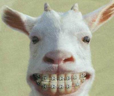 Braces