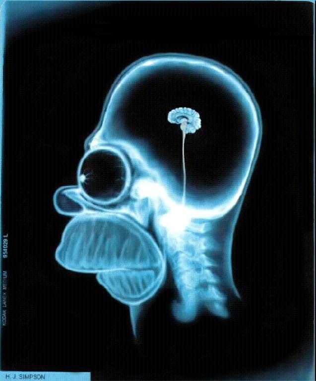 Homer Scan