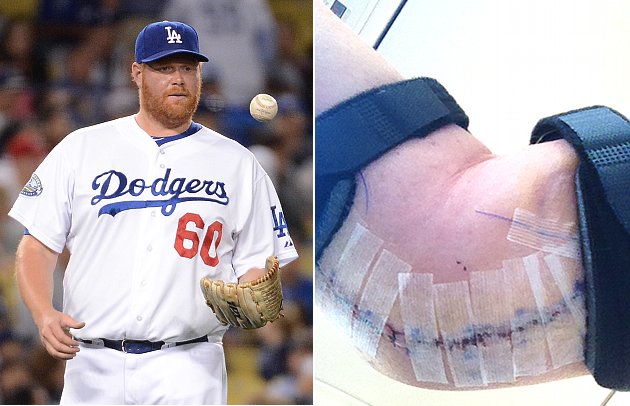 toddcoffeyelbowsurgery072712.jpg