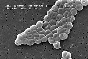 300px-Acinetobacter_baumannii.jpg